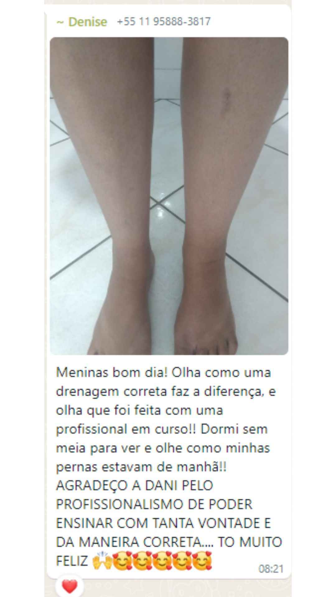 Image Title My Image